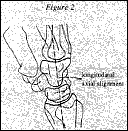 Figure 2 - Copyright – Stock Photo / Register Mark