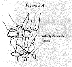 Figure 3A - Copyright – Stock Photo / Register Mark