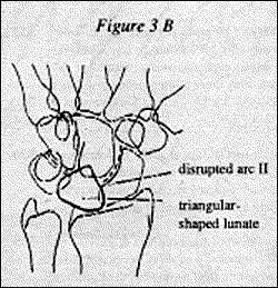 Figure 3B - Copyright – Stock Photo / Register Mark