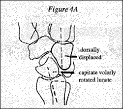 Figure 4A - Copyright – Stock Photo / Register Mark