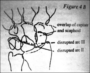 Figure 4B - Copyright – Stock Photo / Register Mark