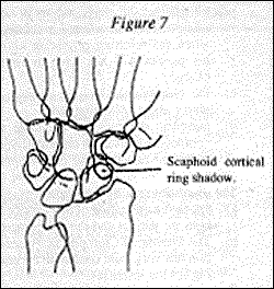 Figure 7 - Copyright – Stock Photo / Register Mark