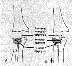 Figure 1 A&B - Copyright – Stock Photo / Register Mark