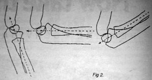 Figure 2 - Copyright – Stock Photo / Register Mark