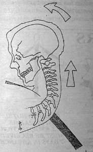 Figure 1 - Copyright – Stock Photo / Register Mark