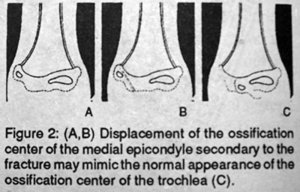 Figure 2A, 2B, 2C - Copyright – Stock Photo / Register Mark