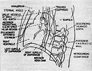 Lateral Chest Diagram - Copyright – Stock Photo / Register Mark