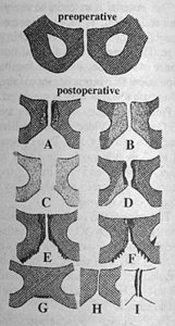 Figure 1 - Copyright – Stock Photo / Register Mark