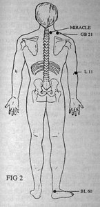 Figure 2 - Copyright – Stock Photo / Register Mark