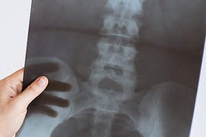 x-ray - Copyright – Stock Photo / Register Mark