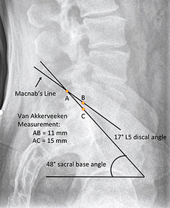 Lateral Lumbar Radiograph - Copyright – Stock Photo / Register Mark