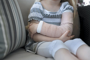 broken arm - Copyright – Stock Photo / Register Mark