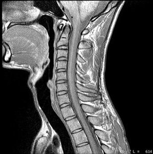 Sagittal MRI Normal - Copyright – Stock Photo / Register Mark