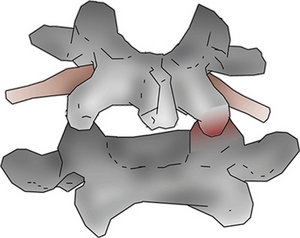 upper vertebra - Copyright – Stock Photo / Register Mark