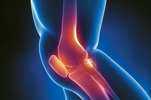 knee pain - Copyright – Stock Photo / Register Mark