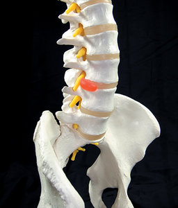 lumbar disc - Copyright – Stock Photo / Register Mark