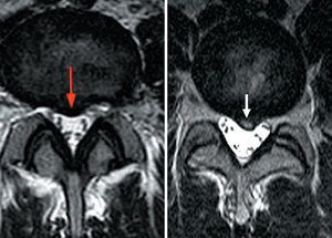 Lumbar Spine - Copyright – Stock Photo / Register Mark