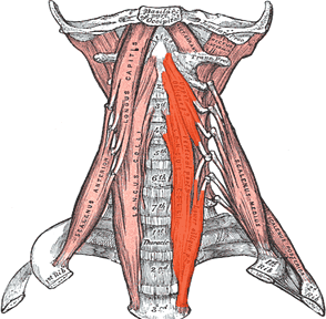 Retropharyngeal Calcific Tendinitis - Copyright – Stock Photo / Register Mark