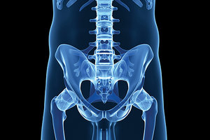 pelvic xray - Copyright – Stock Photo / Register Mark