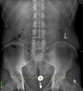 Standing X-ray - Copyright – Stock Photo / Register Mark