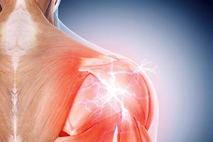 shoulder rehab - Copyright – Stock Photo / Register Mark