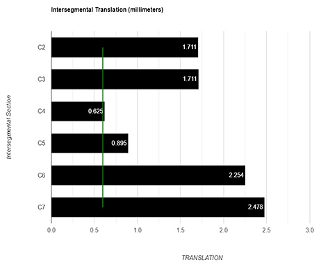 intersegmental translation - Copyright – Stock Photo / Register Mark