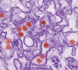 Zika virus - Copyright – Stock Photo / Register Mark